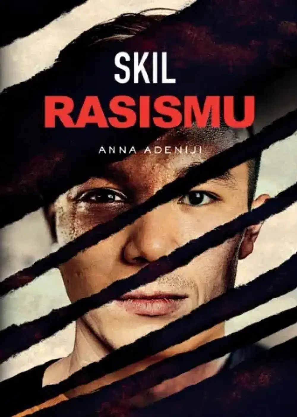 Skil rasismu